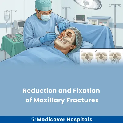 Reduction and Fixation of Maxillary Fractures