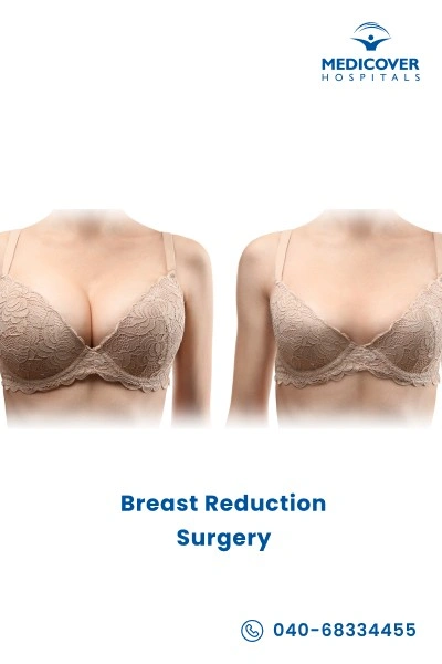 reduction-mammoplasty