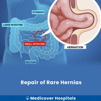 Repair of Rare Hernias