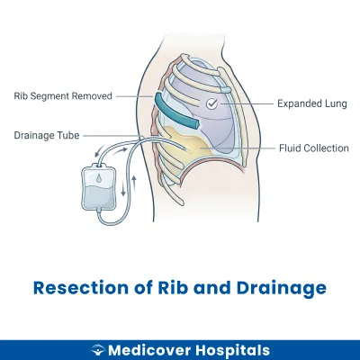 Resection of Rib and Drainage