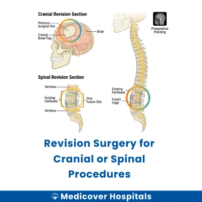 Revision Surgery for Cranial Or Spinal Procedures
