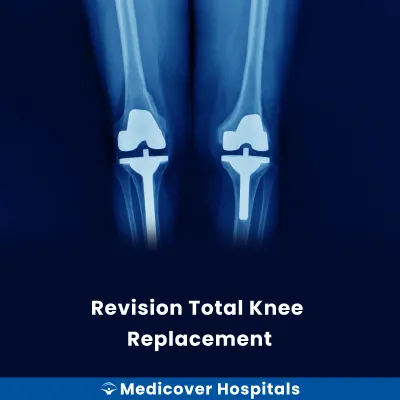 Revision Total Knee Replacement