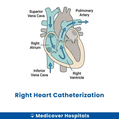 Right Heart Catheterization