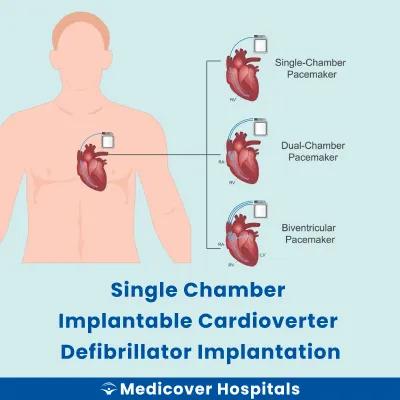 Single Chamber Implantable Cardioverter Defibrillator Implantation
