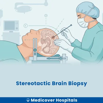 Stereotactic Brain Biopsy