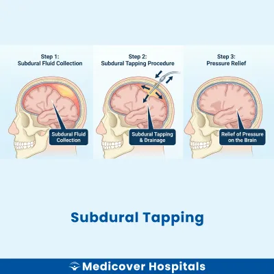 Subdural Tapping