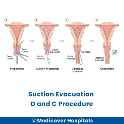 Suction Evacuation D and C Procedure