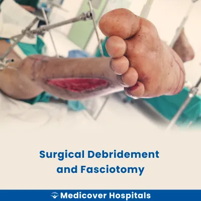 Surgical Debridement and Fasciotomy