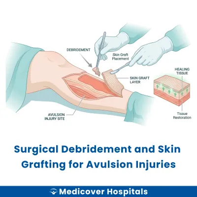 Surgical Debridement and Skin Grafting for Avulsion Injuries