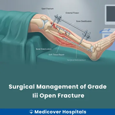 Surgical Management of Grade Iii Open Fracture