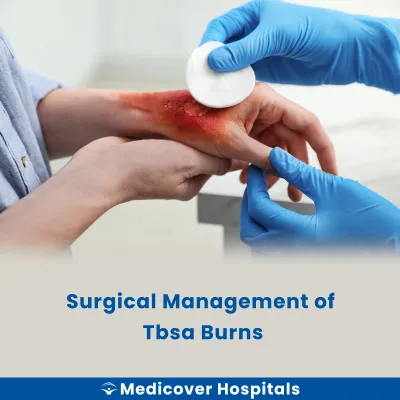 Surgical Management of Tbsa Burns