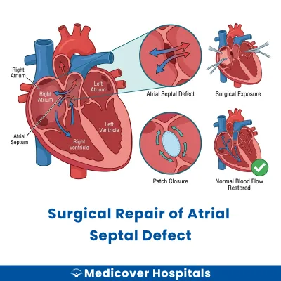 Surgical Repair of Atrial Septal Defect