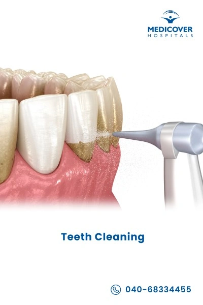 teeth-cleaning