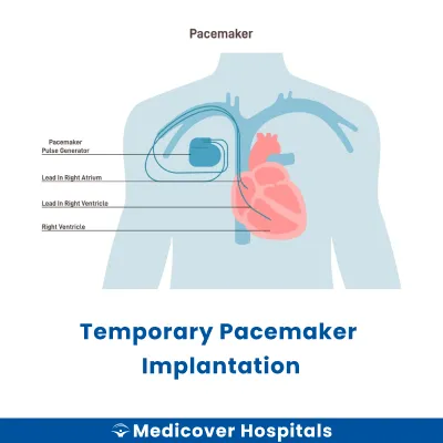 Temporary Pacemaker Implantation