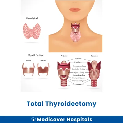 Total Thyroidectomy