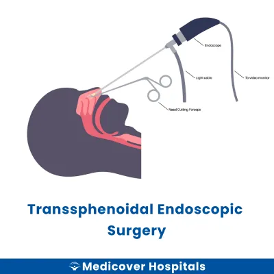 Transsphenoidal Endoscopic Surgery