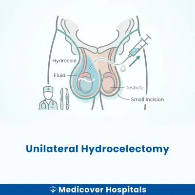 Unilateral Hydrocelectomy