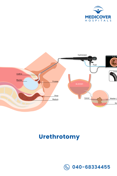 Urethrotomy