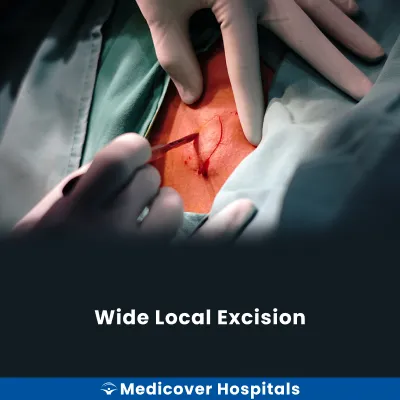 Wide Local Excision