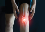Revision Knee Surgery Bone Loss