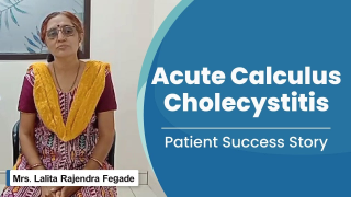 Acute Calculus Cholecystitis