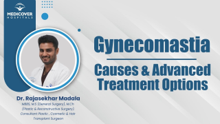 Gynecomastia: Causes And Advanced Treatment Options