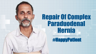 Repair Of Complex Paraduodenal Hernia