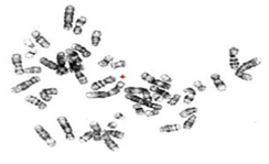 allogenic-bmt-first-time-in-ap-telangana-medicover-2