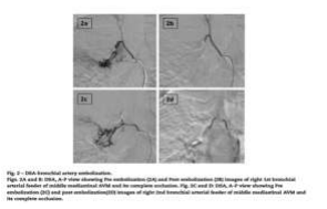 arteriovenous-malformations-in-the-mediastinum-2