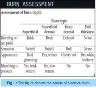 electrical-burns-case