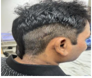 trigeminal-neuralgia-a-suicidal-disease