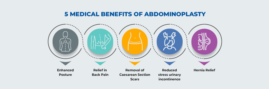 benefits of abdominoplasty
