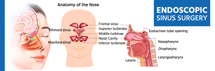 functional-endoscopic-sinus-surgery