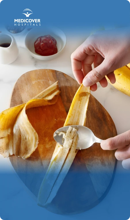 banana peels for acne and pimples