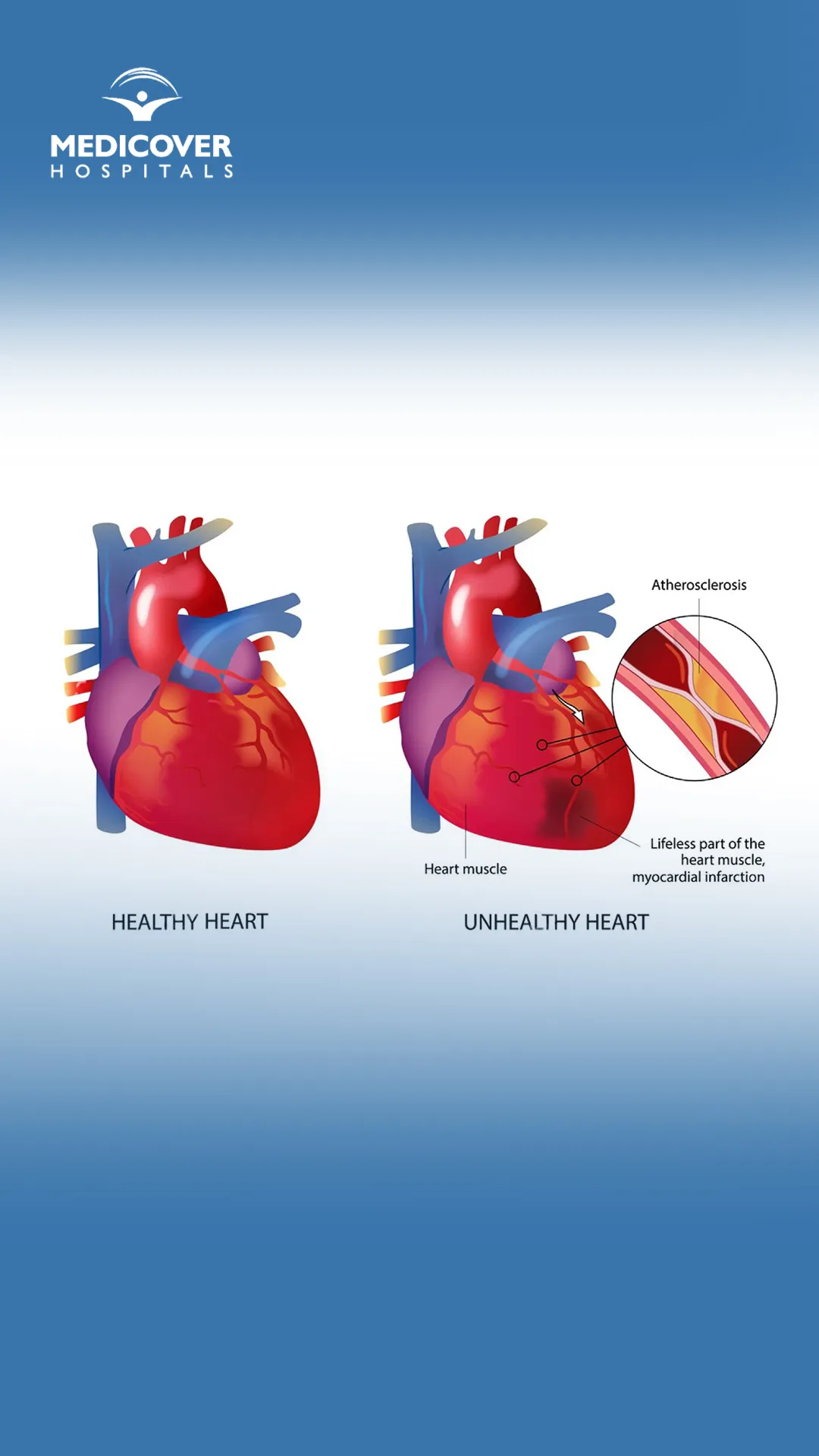 habits that slowly damage your heart