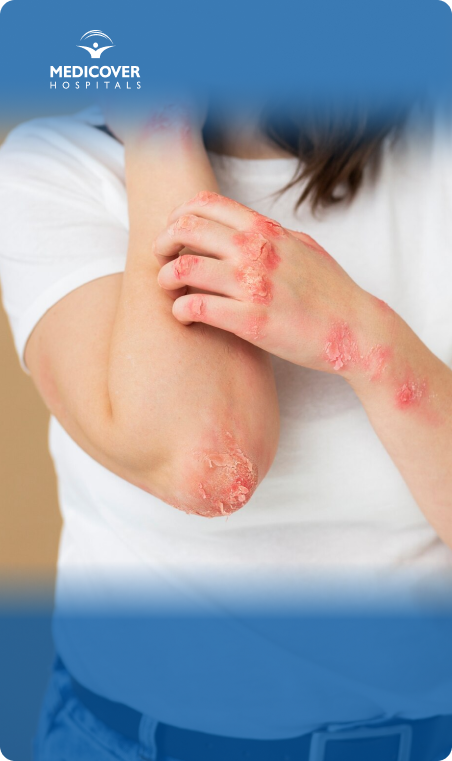 Red Itchy Skin Issues