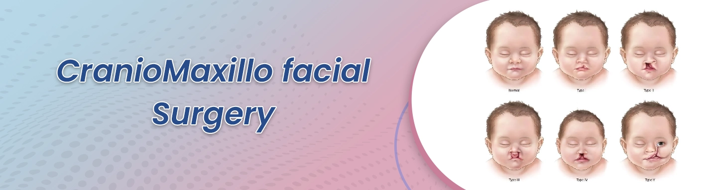 craniomaxillofacial-surgery