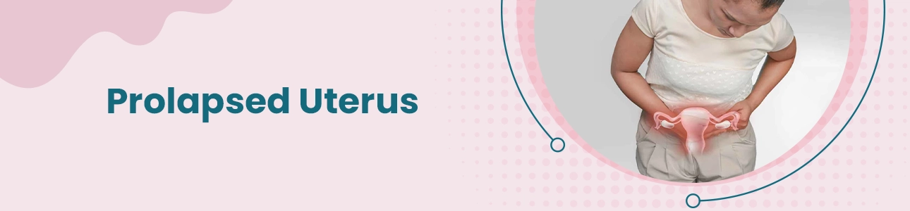Prolapsed Uterus