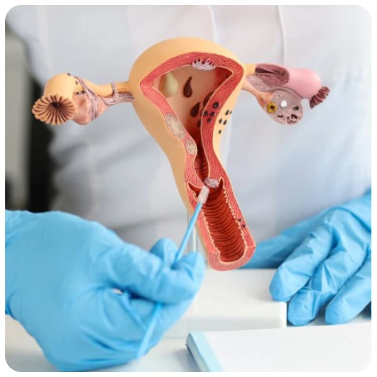 Gynecologic Oncology Treatment