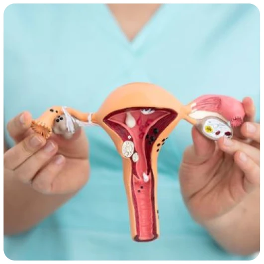 Urogynecology