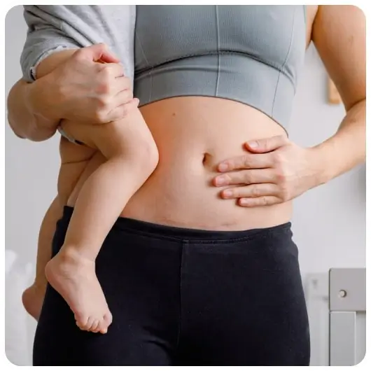 Vaginal Birth After Caesarean (VBAC)